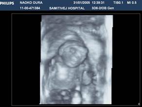 3d and 4d ultrasound pictures baby face